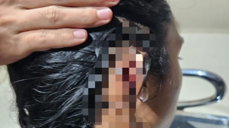 Kericuhan Pemilihan Ketua BEM Unimal Berujung Kekerasan, Tiga Mahasiswa Jadi Korban