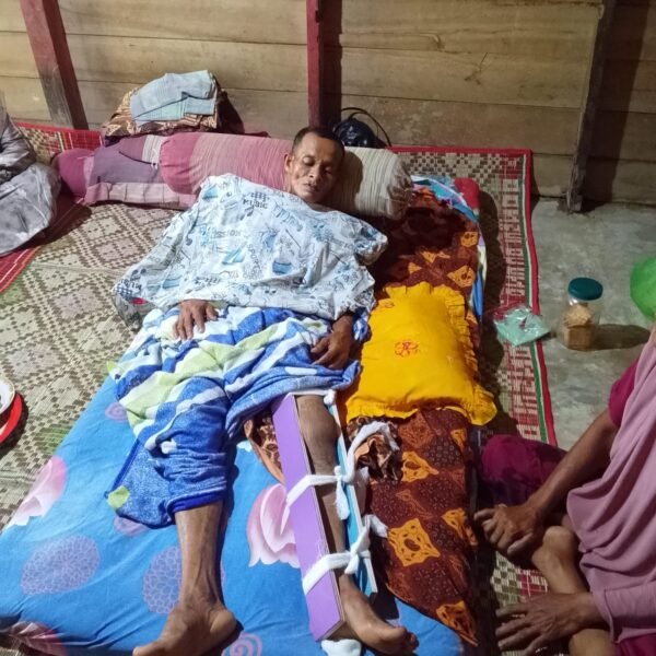 Pasien Operasi Dirujuk ke Banda Aceh, Proses Penanganan di Rumah Sakit Dipertanyakan